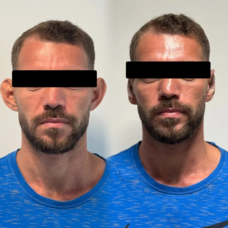 Antes y después de un tratamiento en Salinova